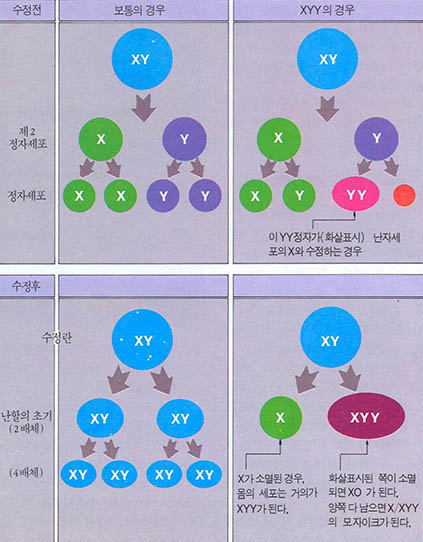 초남성XYY가 생기는 메카니즘.^ 수정전의 단계(위)와 수정후(아래)의 두 시점에서의 경우가 생각된다.