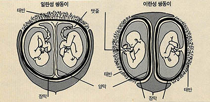 일란성 쌍둥이와 이란성 쌍둥이