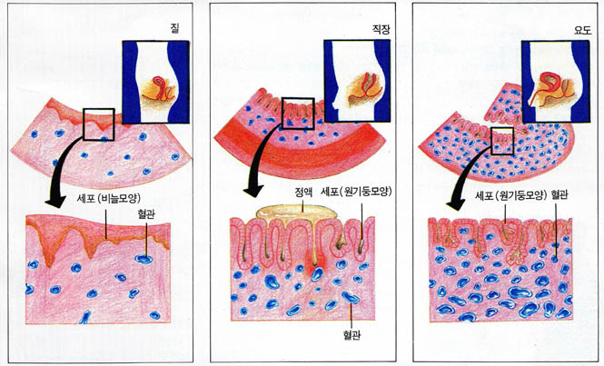 AIDS의 전염경로