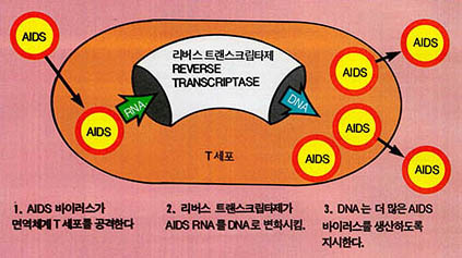 AIDS복제^1.AIDS 바이러스가 면역체계 T세포를 공격한다. 2.리버스 트랜스크립타제가 AIDS RNA를 DNA로 변화시킴. 3.DNA는 더 많은 AIDS 바이러스를 생산하도록 지시한다.