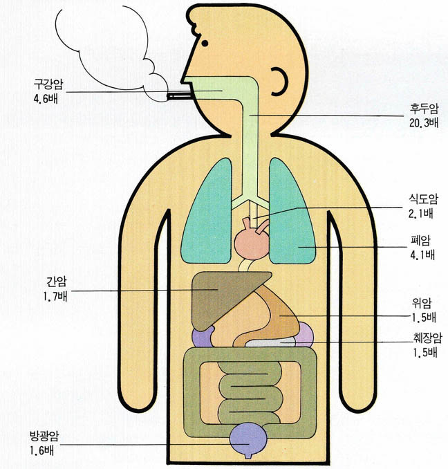 비흡연자에 대비한 흡연자의 암사망률(남자)