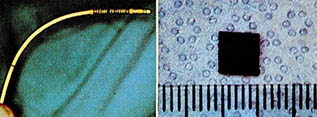형상기억합금제의 혈관학장링(사진오른쪽). 실내온도에서는 부드러우므로 카데테르에 말아붙여(사진 왼쪽) 좁아진 혈관에 삽입한다.
