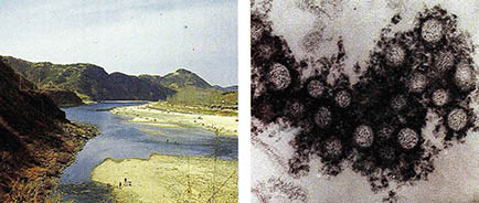 한탄강은 출혈열연구의 메카. 한탄바이러스의 전자현미경 사진