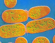 적라균의 컴퓨터처리화상 사람의 장관 속에서 증식하여 배설물을 통해 번진다. 물이나 채소를 통해 전염되므로 상수도가 불완전한 나라에서 감염률이 높다.