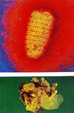 광견병 바이러스 유구낭미충