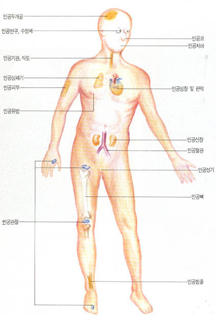 (그림2)인공장기의 실용화