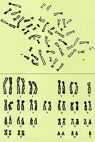 (그림1) 사람의 염색체 (그림2) 크기 순서대로 배열한 남자의 가성염색체