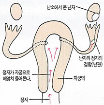 수정은 난관 팽대부에서