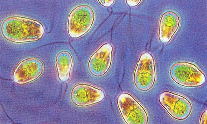 조류(algae)^그들은 태양에너지를 이용, 수소를 생산할수 있는데, 수소는 발열량이 높고 대기오염이 없는 이상적인 에너지의 하나