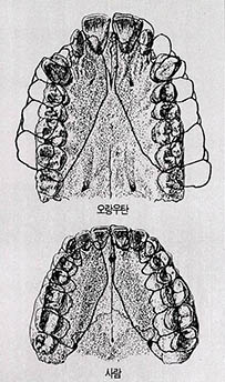 (그림 3)사람과 오랑우탄의 이의 배열