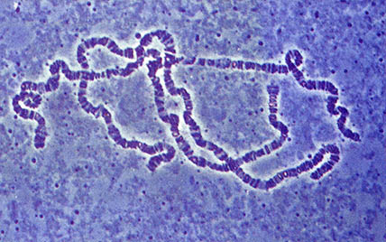 초파리의 침샘염색체. 초파리의 침샘에는 거대염색체가 있다. 