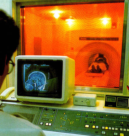 핵자기공명장치(MRI)로 뇌의 이상을 형태적으로 살피고 있다.