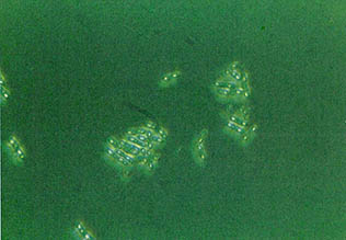 NE-87을 위상차 현미경으로 1천배 확대한 사진
