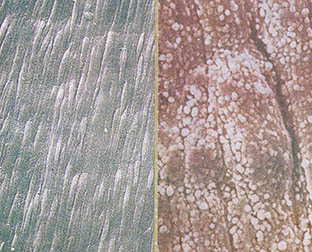탯줄의 주사현미경 사진. 왼쪽이 비흡연자 오른쪽이 흡연임산부