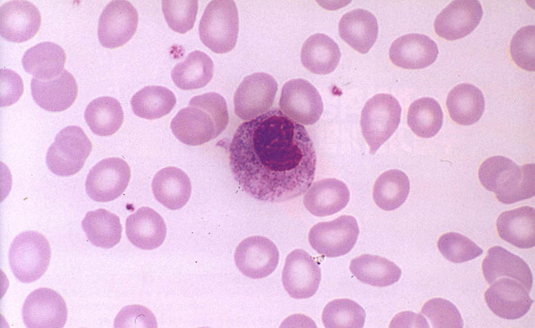 혈액의 4백배 확대사진. 가장 많은 것이 적혈구, 가운데가 백혈구, 작은 점이 혈소판이다. 혈액 1㎣에는 적혈구 약 4백50만개, 백혈구 5천개, 혈소판 15-20만개가 떠 있다.