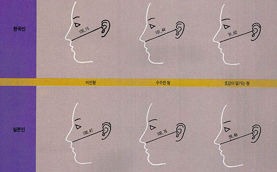 (그림4) 각 타입별 얼굴 중안부의 돌출정도를 나타내는 비하점방사경의 측정치