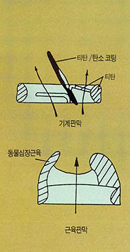 (그림3) 인공심장판막