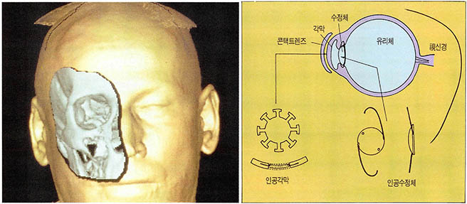 (그림1) 안과용 고분자