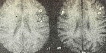 작시 남녀의 뇌차이 MRI 스캔