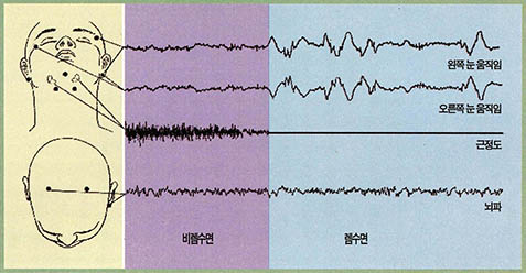(그림)수면 다원 검사로 렘수면과 비렘수면 구분