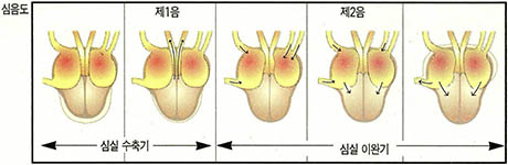 (그림1) 심음주기와 심장상태