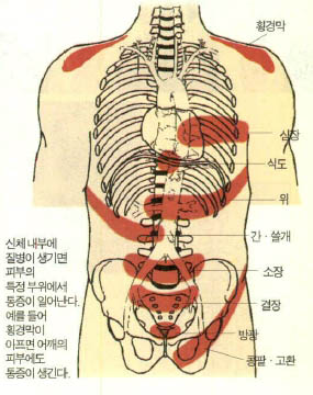 (그림1)피부에 연관통을 일으키는 내장 부위^신체 내부에 질병이 생기면 피부의 특정 부위에서 통증이 일어난다. 예를 들어 횡경막이 아프면 어깨의 피부에도 통증이 생긴다.