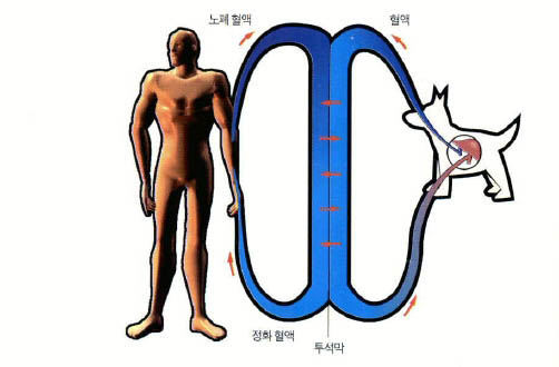 (그림2)원시적 형태의 인공간^간질환 환자의 혈액이 개의 간으로 흘러가 정화된 후 다시 몸으로 돌아오는 원리다. 1988년 개발됐다.