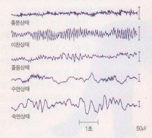 (그림2)심신 상태에 따른 뇌파의 유형