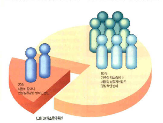 (그림3) 왜소증의 원인