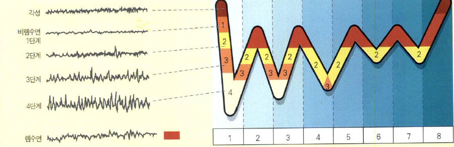 (그림2) 수면과 각성 시기에 관찰되는 뇌파^잠이 들면 4단계로 구분되는 비렘수면이 먼저 발생하고, 90분 간격으로 꿈을 꾸는 렘수면이 되풀이 된다. 시간이 지날수록 깊은 수면(3-4단계)이 점차 줄어든다.