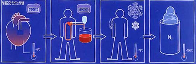 냉동인간 만드는 방법