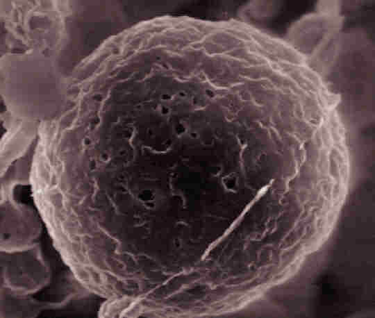 유산균을 위산으로부터 보호하는 원형 캡슐의 전자현미경 사진.