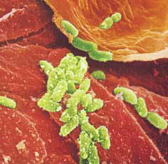 피부 표면에 공생하는 수백만 세균 중 일부(녹색)