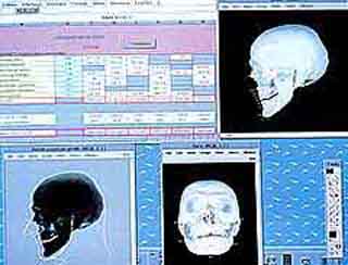 유적에서 발굴된 옛사람 머리뼈의 특성을 컴퓨터로 분석하는 모습.이 자료는 머리뼈의 주인이 어느 종족에 속했는지 알려주는 중요한 단서다.