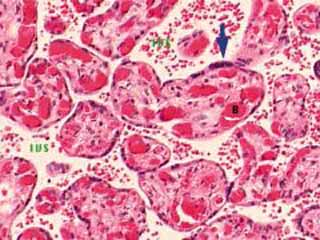 태반 융모의 정자현미경 사진.파란 화살표로 표시된 부분이 융모를 덮고 있는 합포체성 영양세포막이다.융모 사이의 공간(IVS,Intervillus space)은 산모에게서 온 적혈구로 가득하다.