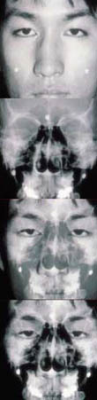 (그림4) 머리뼈와 얼굴생김새 간의 상관관계