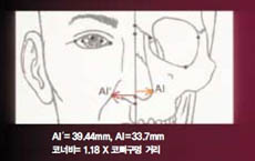 (그림8) 한국인의 코뼈구멍과  코너비 사이의 관계