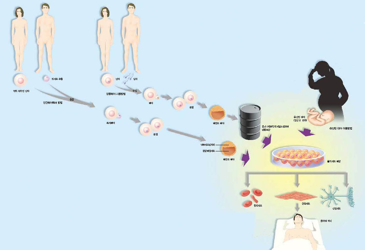 (그림) 배아줄기세포 얻는 3가지 방법