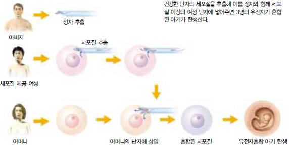 (그림1) 유전자혼합 아기의 탄생과정