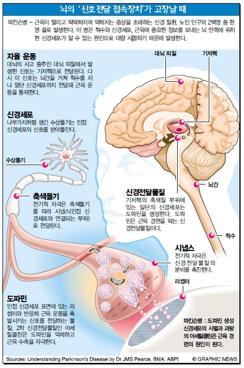 뇌의 '신호전달 접속장치'가 고장날 때