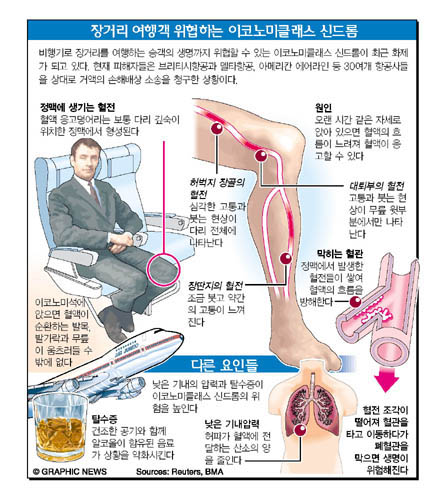 장거리 여행객 위협하는 이코노미클래스 신드롬