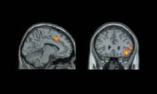 기능적 자기공명영상촬영장치(fMRI)로 촬영한 결과. 따돌림을 당하 면 두뇌의 전방대상피질(왼쪽)과 전두엽 대뇌피질이 활동적으로 변 2 했다.