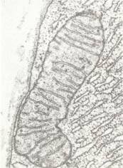 진핵세포의 세포내 소기관인 미토콘드리아의 전자현미경 사진. 독자적인 DNA를 갖고 필요한 단백질을 스스로 만 든다.