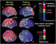 쌍둥이 뇌의 MRI 사진. 파란색은 상관관계가 작고 붉은색은 큼을 나타낸다. 일란성 쌍둥이(왼쪽)가 이란성 쌍둥이보다 상관관계가 훨씬 큼을 알 수 있다.