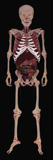 정 교수 연구실에서 직접 제작한 인체의 3차원 입체영상. 뼈와 장기 같은 인체 내부. 정 교수는 향후 이를 교육 목적으로 활용할 계획이라고 밝혔다.