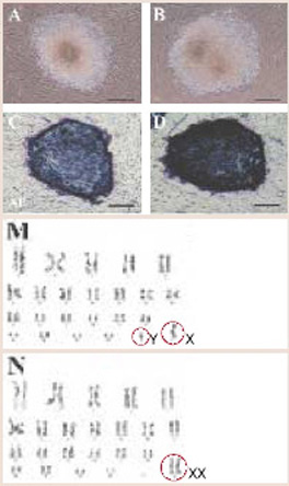 남성(A)과 여성(B) 환자에게서 얻은 줄기세포에 화학 물질을 넣어 모두 만능 분화능력을 가졌음을 확인했고(C:남성, D:여성), 각각 정상 남성 염색체(M)와 여성 염색체(N)를 갖고 있다는 것도 확인했다.