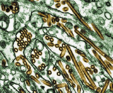 금빛으로 보이는 부분이 H5N1형 조류독감 바이러스. 사람을 공격할 수 없다고 알려져 있었으나 최근 인체감염이 확인됐다.