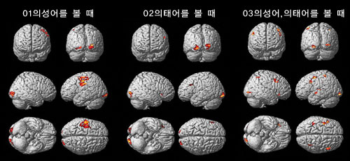 의성어와 의태어를 볼 때 대뇌 활성 부위^의성와 의태어를 단어로 보는 동안 뇌에서 활성화되는 부위를 자기공명영상(fMRI)으로 촬영했다(노랗고 빨갛게 표시된 부분). 브로드만 영역 19번(BA19)은 의성어(01)나 의태어(02)를 볼 때 공통적(03)으로 활성화되는 부위 중 하나다. BA19는 얼굴 인식에 중요한 역할을 한다.