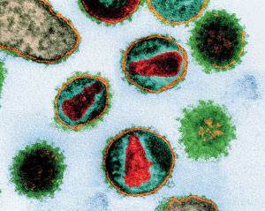 후천성면역결핍증(AIDS)을 일으키는 에이즈 바이러스(HIV)의 전자현미경 사진. 컴퓨터로 색을 입혔다. 에이즈 바이러스는 역전사효소를 갖고 있는 레트로바이러스의 일종이다.