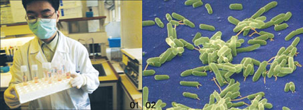 01 홍콩대 연구원이 중증급성호흡기증후군(SARS, 사스) 바이러스가 담긴 샘플을 운반하고 있다. 홍콩대 연구팀은 사스 환자의 조직에서 이 병을 일으키는 코로나 바이러스를 처음 찾아냈다. 02 항생제에도 죽지 않는 슈퍼박테리아의 사진, 내성이 생긴 녹농균을 전자현미경으로 촬영했다.